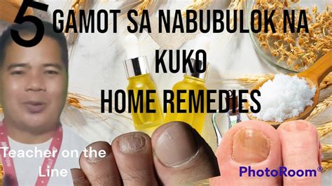 cream para sa patay na kuko|Pag.